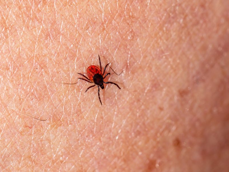 How to Deal With Ticks: Risks of Tick Bites and Prevention Tips